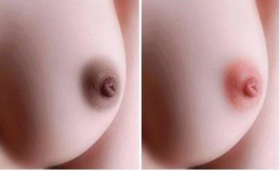 ket-qua-sau-khi-xoa-xam-nhu-hoa