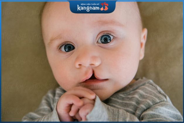 Hở hàm ếch có chữa được không