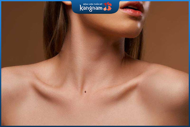 Nốt ruồi chính giữa ức phụ nữ