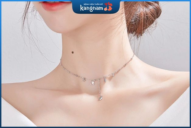 Việc xóa nốt ruồi hay không phụ thuộc vào mong muốn của mỗi người