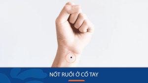 Nốt ruồi cổ tay trái/phải: Bí ẩn về tính cách, vận mệnh và tình duyên