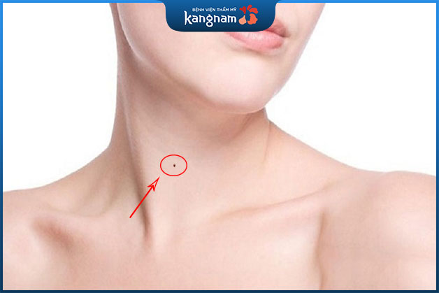 Những người sở hữu nốt ruồi ở cổ có tướng phú quý, giàu sang