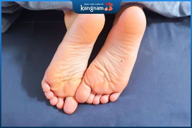 Nốt ruồi ở lòng bàn chân phụ nữ là người thật thà