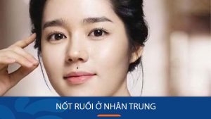Nốt ruồi nhân trung: Giải mã ý nghĩa tướng số may mắn Đàn ông & Phụ nữ