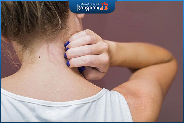 Nốt ruồi ở sau cổ mang đến sự may mắn cho người sở hữu