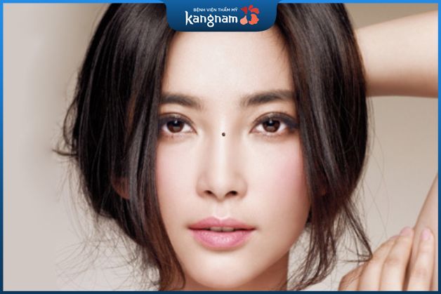 Nốt ruồi sơn căn khá xui xẻo