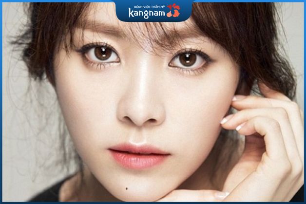 Nốt ruồi nằm ở trên cằm