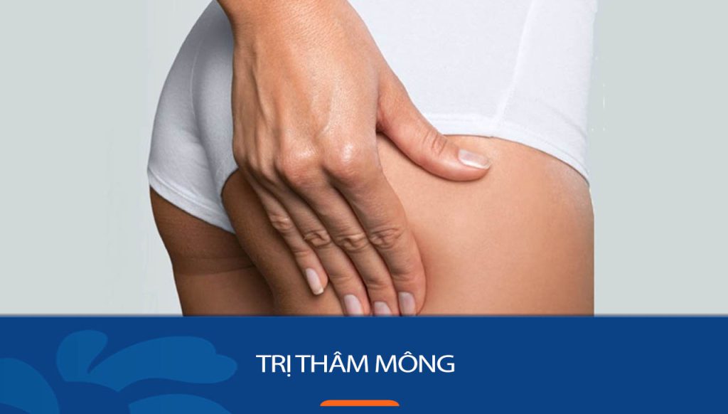 10 Cách trị thâm mông tự nhiên tại nhà hiệu quả, nhanh chóng