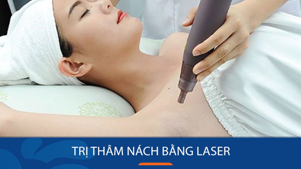 Trị thâm nách bằng Laser – Hết thâm sạm – Nách trắng hồng