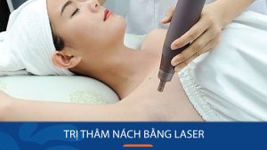 Trị thâm nách bằng Laser – Hết thâm sạm – Nách trắng hồng