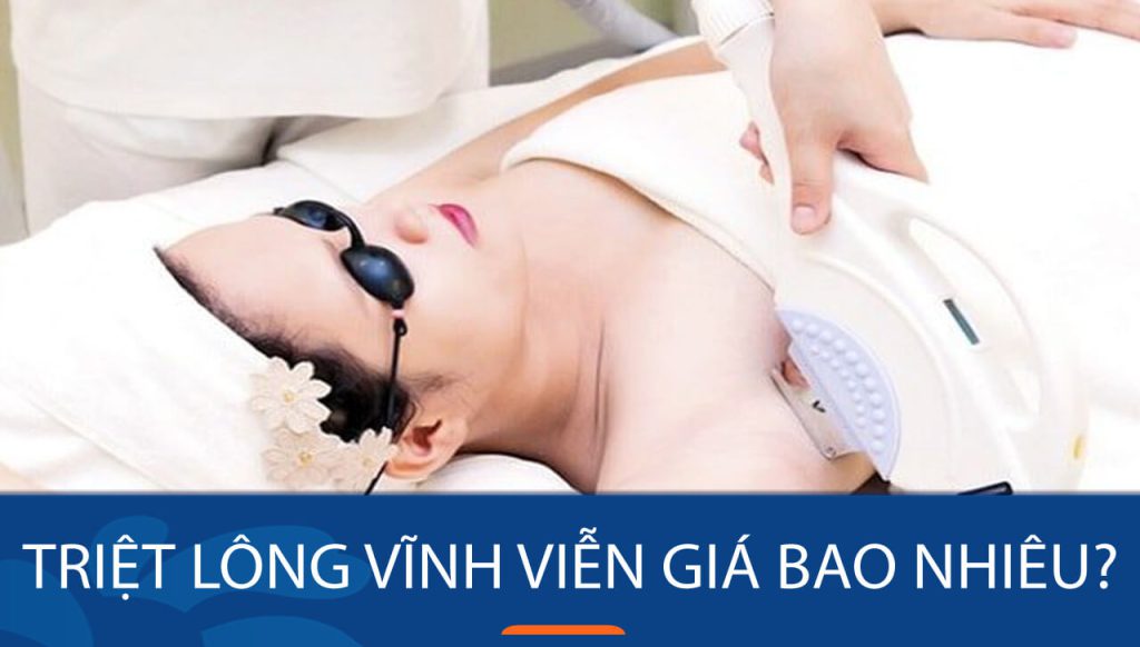 Triệt lông vĩnh viễn giá bao nhiêu? Bảng giá SIÊU RẺ, ƯU ĐÃI HẤP DẪN