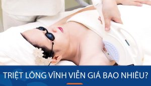 Triệt lông vĩnh viễn giá bao nhiêu? Bảng giá SIÊU RẺ, ƯU ĐÃI HẤP DẪN