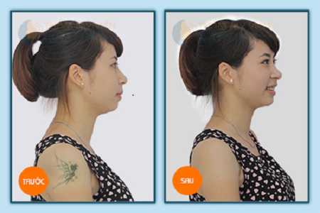 Trung tâm xóa hình xăm 2