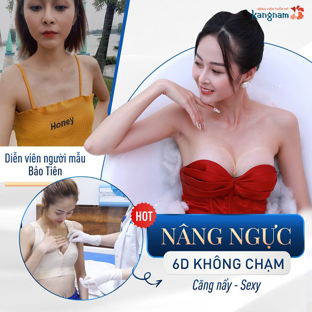 Nâng ngực đường nách đem lại tính thẩm mỹ cao