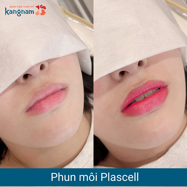 Bạn Thúy Ngân (26 tuổi tại Hà Nội)