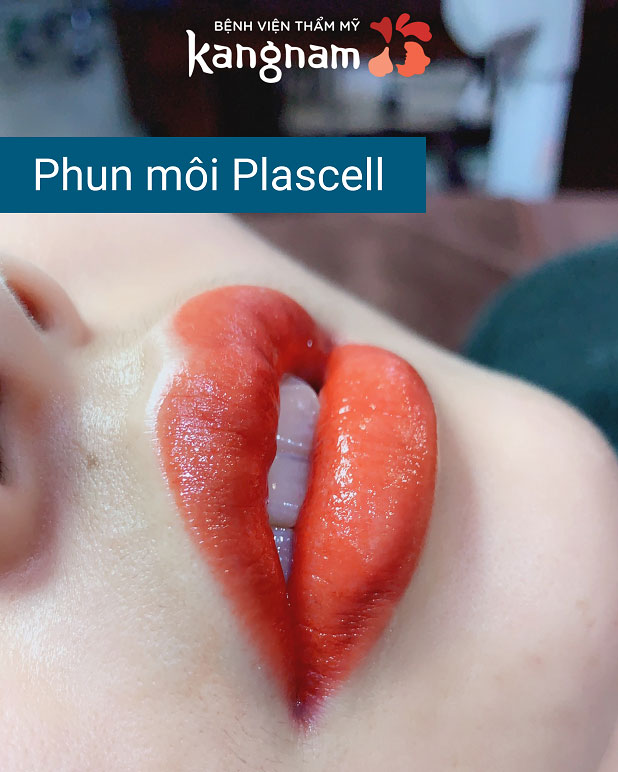 Phun môi Plascell cho kết quả đẹp ngay sau khi thực hiện