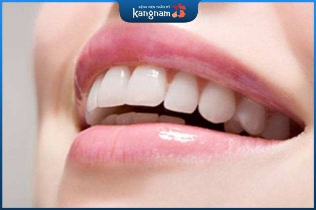 Làm răng sứ Venus tương đối tốt