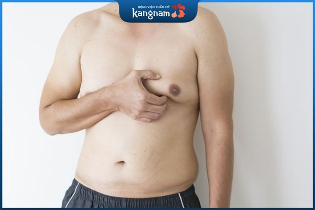 Cẩn thận khi ngực ở quá mức ở đàn ông