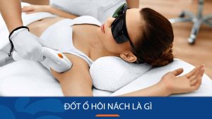 Đốt ổ hôi nách là gì? Có hiệu quả không? Giá bao nhiêu?