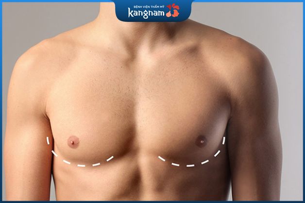 Quá trình hồi phục sau phẫu diễn ra khoảng 4-6 tuần