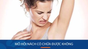 Mồ hôi nách có chữa được không? Bí kíp điều trị nhanh