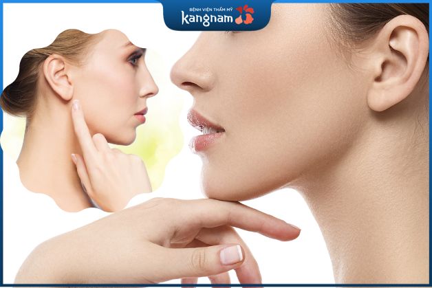 Nâng mũi bọc cân cơ là phương pháp dùng sụn nhân tạo