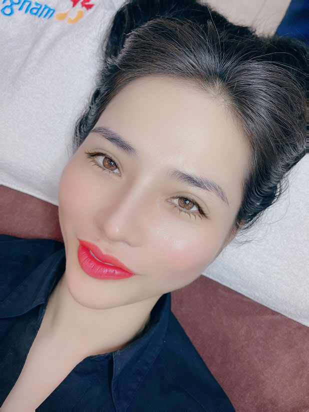 Phun môi công nghệ cao, an toàn, không xâm lấn