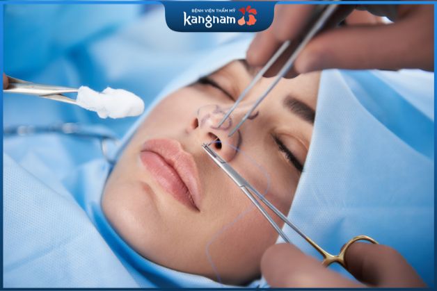 Quy trình nâng mũi bọc sụn thái dương