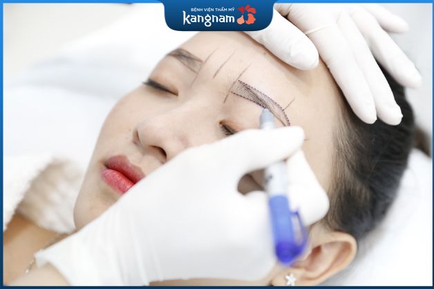 Quy trình điêu khắc lông mày cần đáp ứng điều kiện vô khuẩn