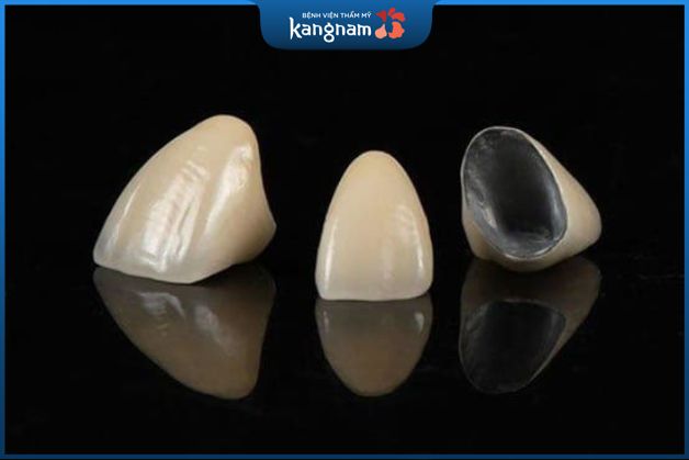 Răng sứ kim loại thường