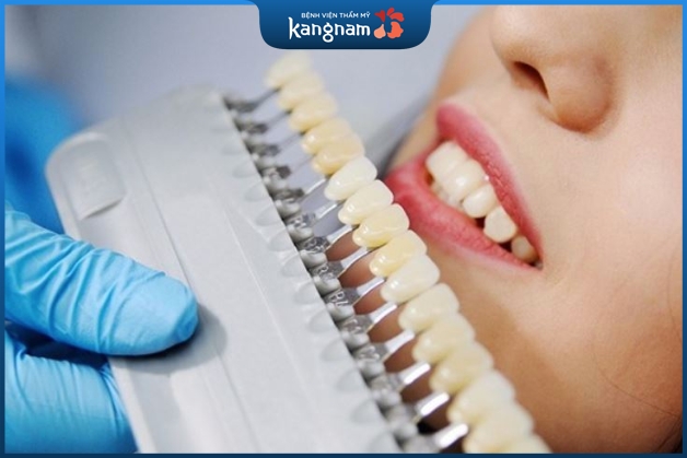 Răng toàn sứ Venus có nhiều ưu điểm tuyệt vời