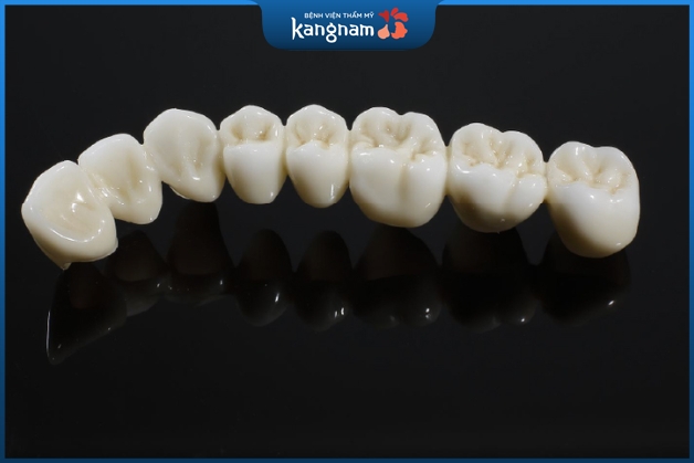 Răng sứ Venus làm từ 100% sứ nguyên chất