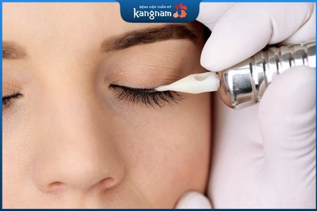 Thời gian nối mi sau phun mí tùy vào nhiều yếu tố