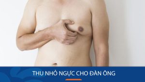 Phương pháp thu nhỏ ngực an toàn và hiệu quả