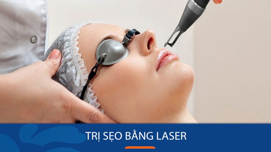Điều trị sẹo bằng laser: Giải pháp hoàn hảo cho làn da mịn màng