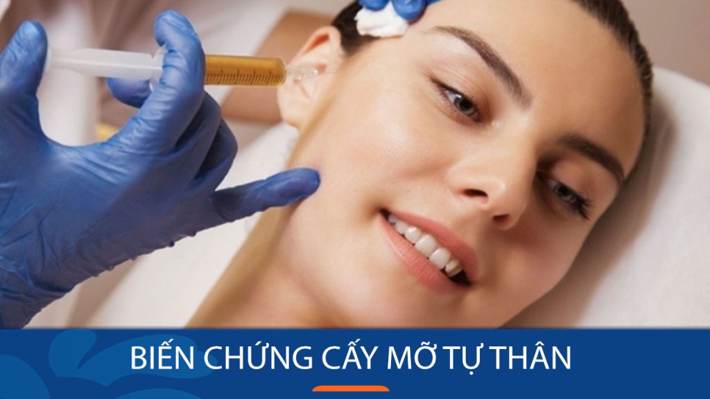 Biến chứng cấy mỡ tự thân: Bác sĩ kangnam giải đáp