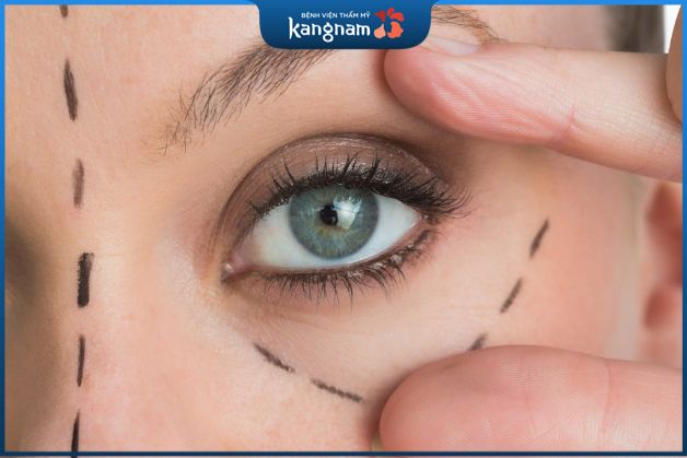 nên thực hiện phun mí dưới, giúp đôi mắt có sức sống, có chiều sâu