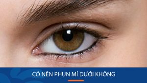 Có nên phun mí dưới không? Cần lưu ý điều gì trong quá trình làm