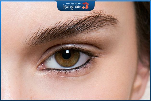 Có nên phun mí dưới không