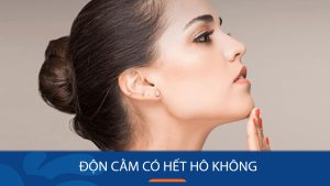Độn cằm có hết hô không? Trường hợp cải thiện và khi nào không hiệu quả