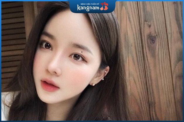 Nốt ruồi gần mắt, dưới lông mày