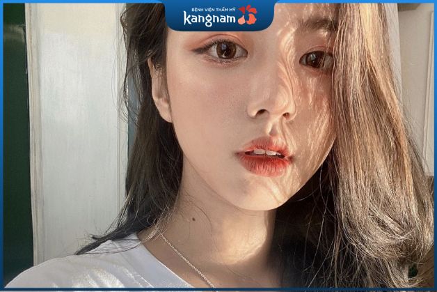 Nốt ruồi ở cổ cũng là một trong những nốt ruồi xui xẻo