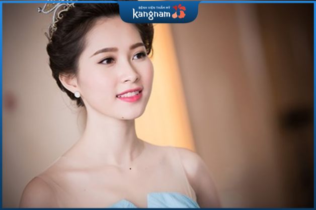 Xem tướng nốt ruồi ở hõm cổ nữ tốt hay xấu