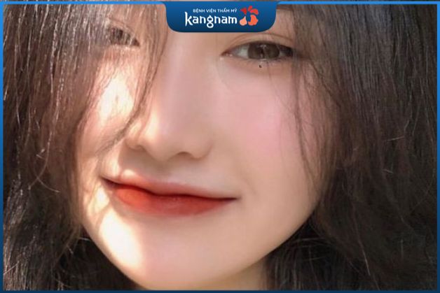 Nốt ruồi mọc dưới lệ đường là phụ nữ đa sầu, đa cảm