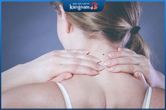 Vị trí nốt ruồi ở sau cổ