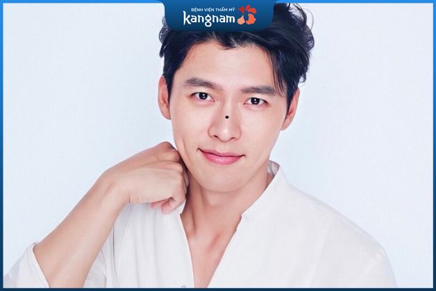 Nốt ruồi ở sống mũi cần cẩn thận sức khỏe