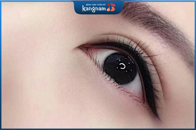 phun mí mở tròng vẫn được ưa chuộng và nhiều người yêu thích hơn