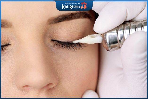 Nhược điểm phun mí mắt mèo