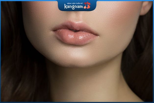 Tiêm filler môi trái tim sẽ hết sưng sau khoảng từ 5 - 7 ngày