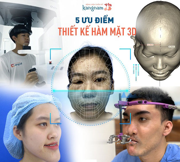 Trải nghiệm chỉnh Hàm Mặt với công nghệ hiện đại tại Kangnam